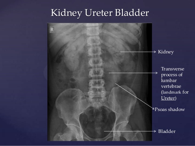 Mandela Effect - Kidney Proof - Internal Organs Changed Position, page 2