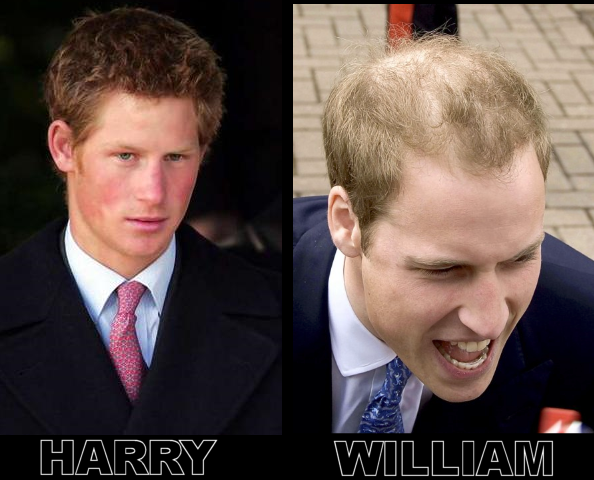 prince william balding 2010 prince. prince william balding 2010 prince. PRINCE WILLIAM BALDING 2010