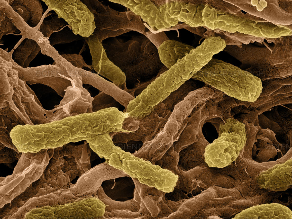 Микробиологические на аэробные микроорганизмы. Термофилы бактерии. Bacillus термофилы. Термофильные молочнокислые бактерии. Термофилы это микробиология.
